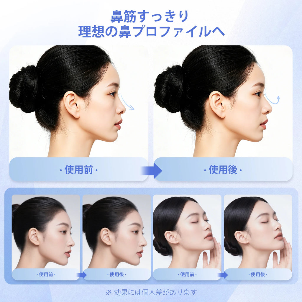 Sculpté™ EMS Nose Sculpting Device — Lift, Contour & Snatch at Home